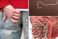 Allarme vermi intestinali in diverse scuole di Napoli: sintomi e rischi