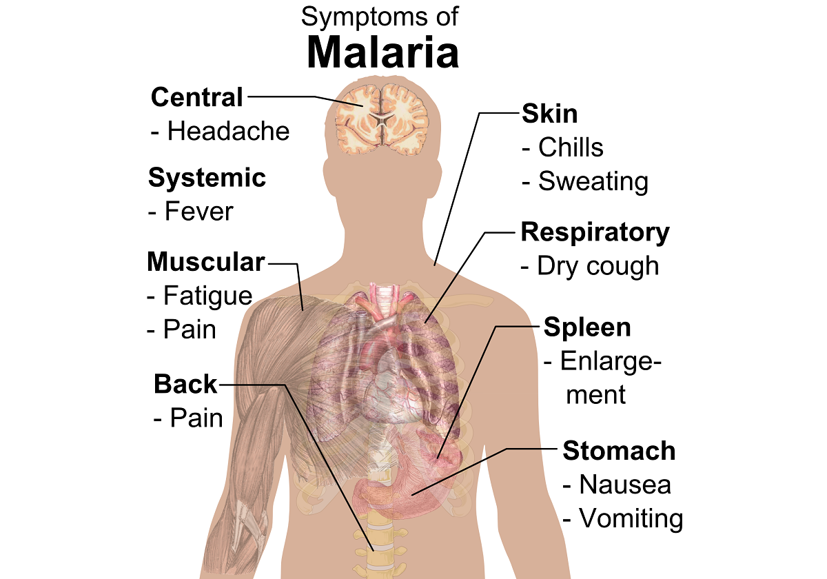 Vaccino contro Malaria: perché è un successo con molte preoccupazioni