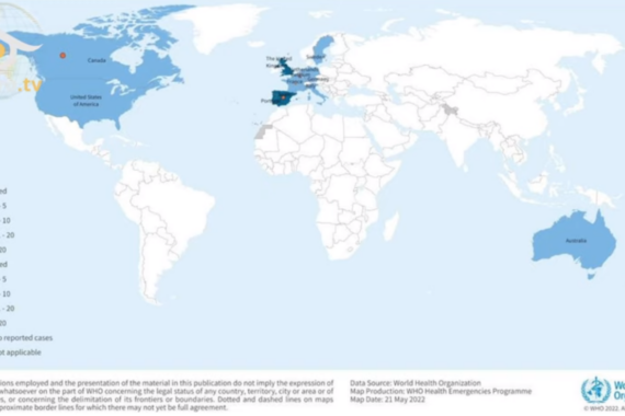 Paesi con Vaiolo delle scimmie: Mappa cela 2 aspetti inquietanti