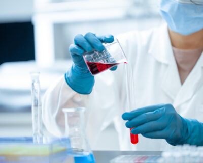 Atrofia muscolare spinale curata in utero per la prima volta